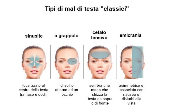 Tipi di mal di testa Tipi di mal di testa