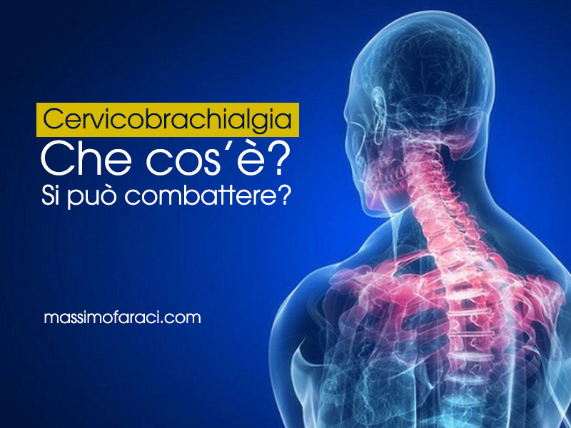 Cervicobrachialgia - Massimo Faraci