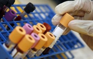 analisi del sangue per gli sportivi analisi del sangue quando farle | esami del sangue