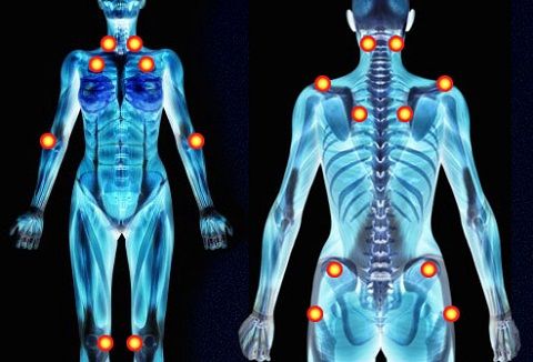 Trigger Point - Osteopatia