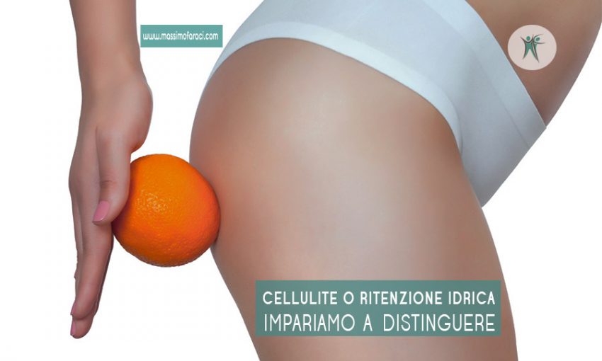 Cellulite o ritenzione idrica